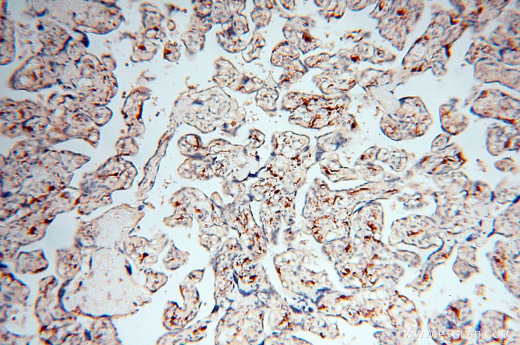 Immunohistochemistry (IHC) staining of human placenta tissue using RANBP9 Polyclonal antibody (17755-1-AP)