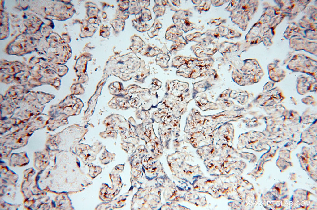 IHC staining of human placenta using 17755-1-AP