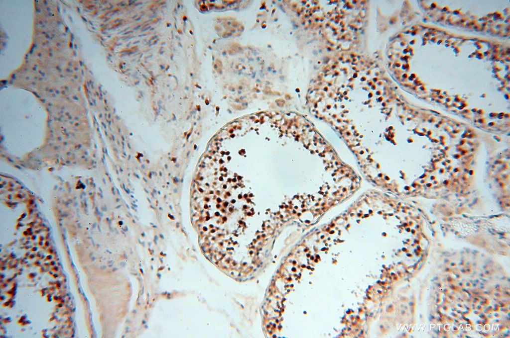 Immunohistochemistry (IHC) staining of human testis tissue using RANBP9 Polyclonal antibody (17755-1-AP)