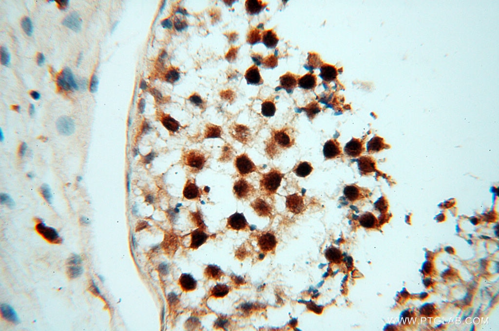 Immunohistochemistry (IHC) staining of human testis tissue using RANBP9 Polyclonal antibody (17755-1-AP)