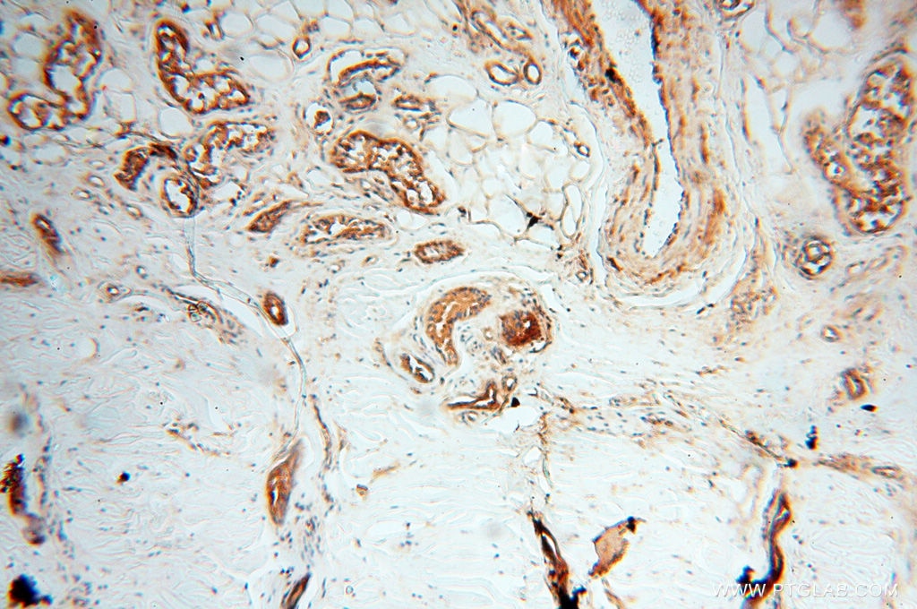 Immunohistochemistry (IHC) staining of human skin tissue using RANBP9 Polyclonal antibody (17755-1-AP)