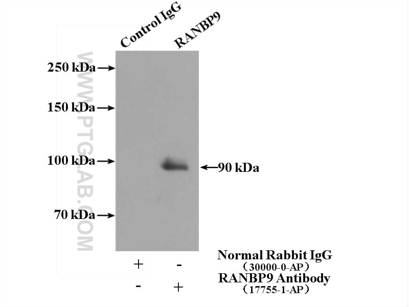 Immunoprecipitation (IP) experiment of HeLa cells using RANBP9 Polyclonal antibody (17755-1-AP)