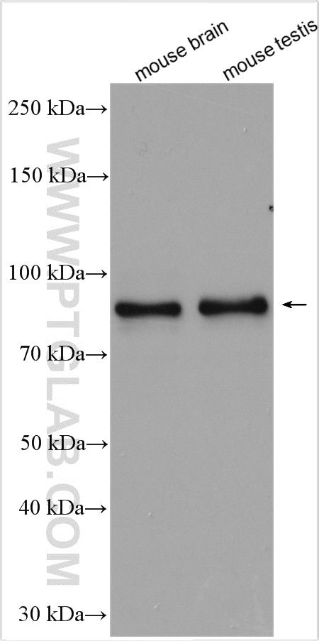 Western Blot (WB) analysis of various lysates using RANBP9 Polyclonal antibody (17755-1-AP)