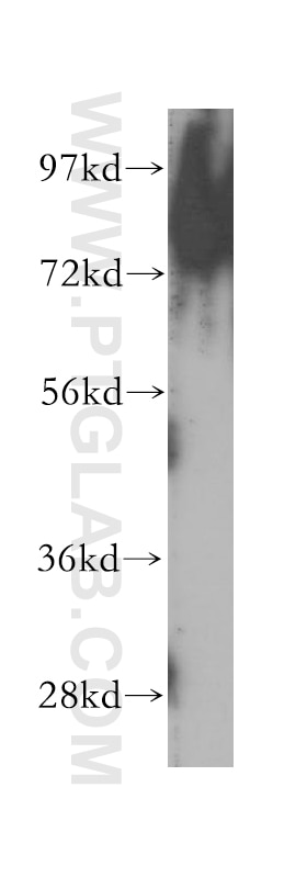 Western Blot (WB) analysis of mouse testis tissue using RANBP9 Polyclonal antibody (51038-1-AP)