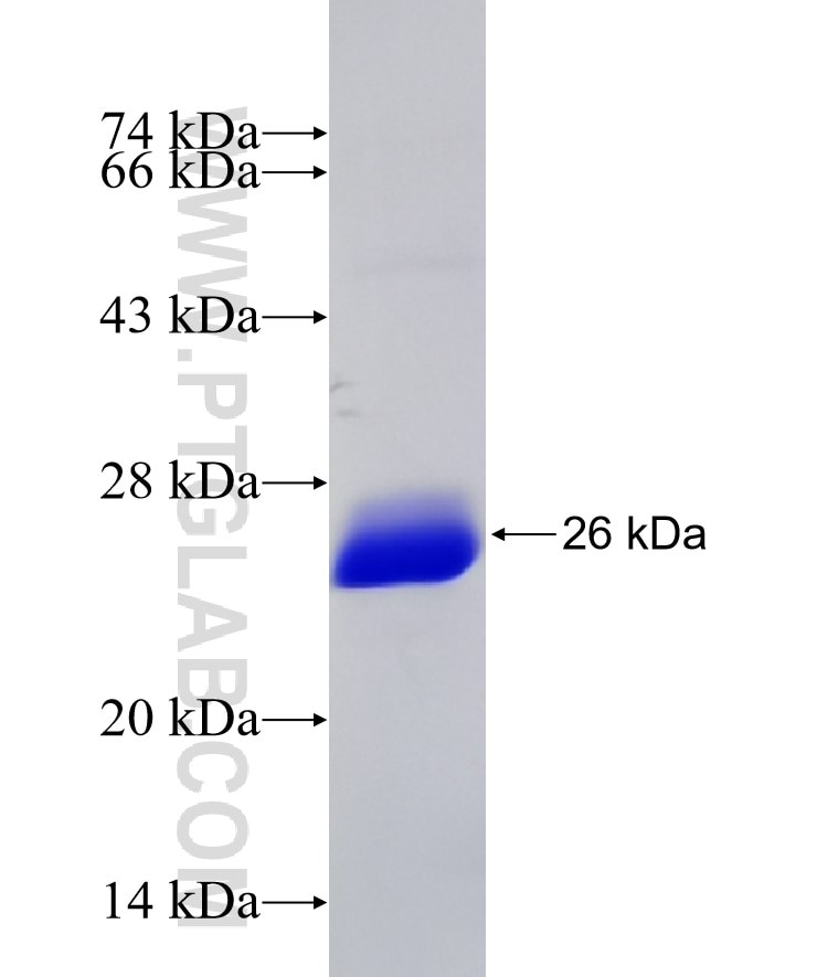 RANBP9 fusion protein Ag32327 SDS-PAGE RANBP9 fusion protein Ag32327 SDS-PAGE