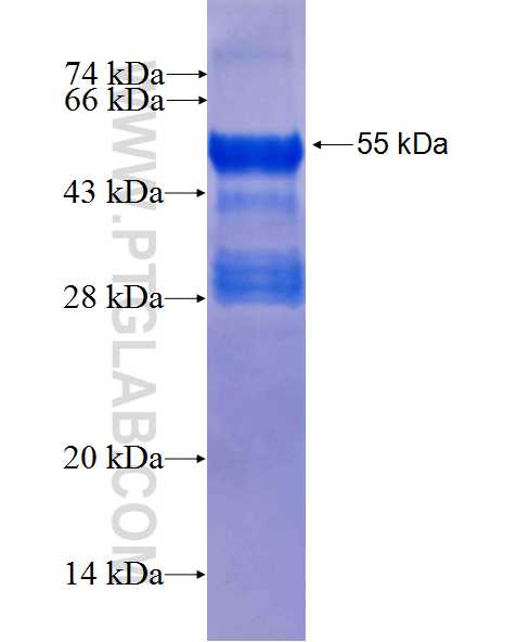 RANBP9 fusion protein Ag0428 SDS-PAGE