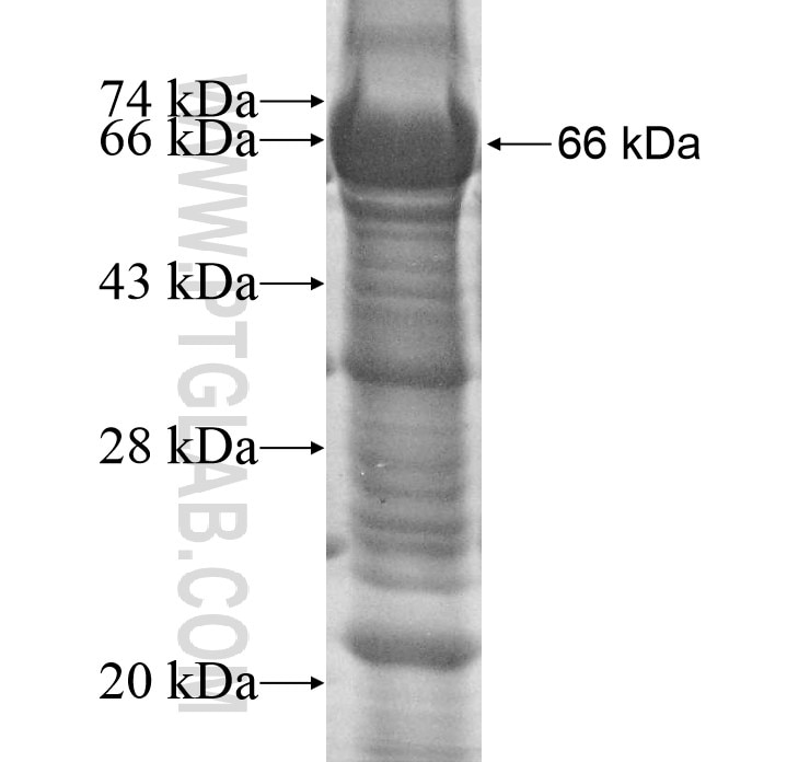 RANBP9 fusion protein Ag12112 SDS-PAGE
