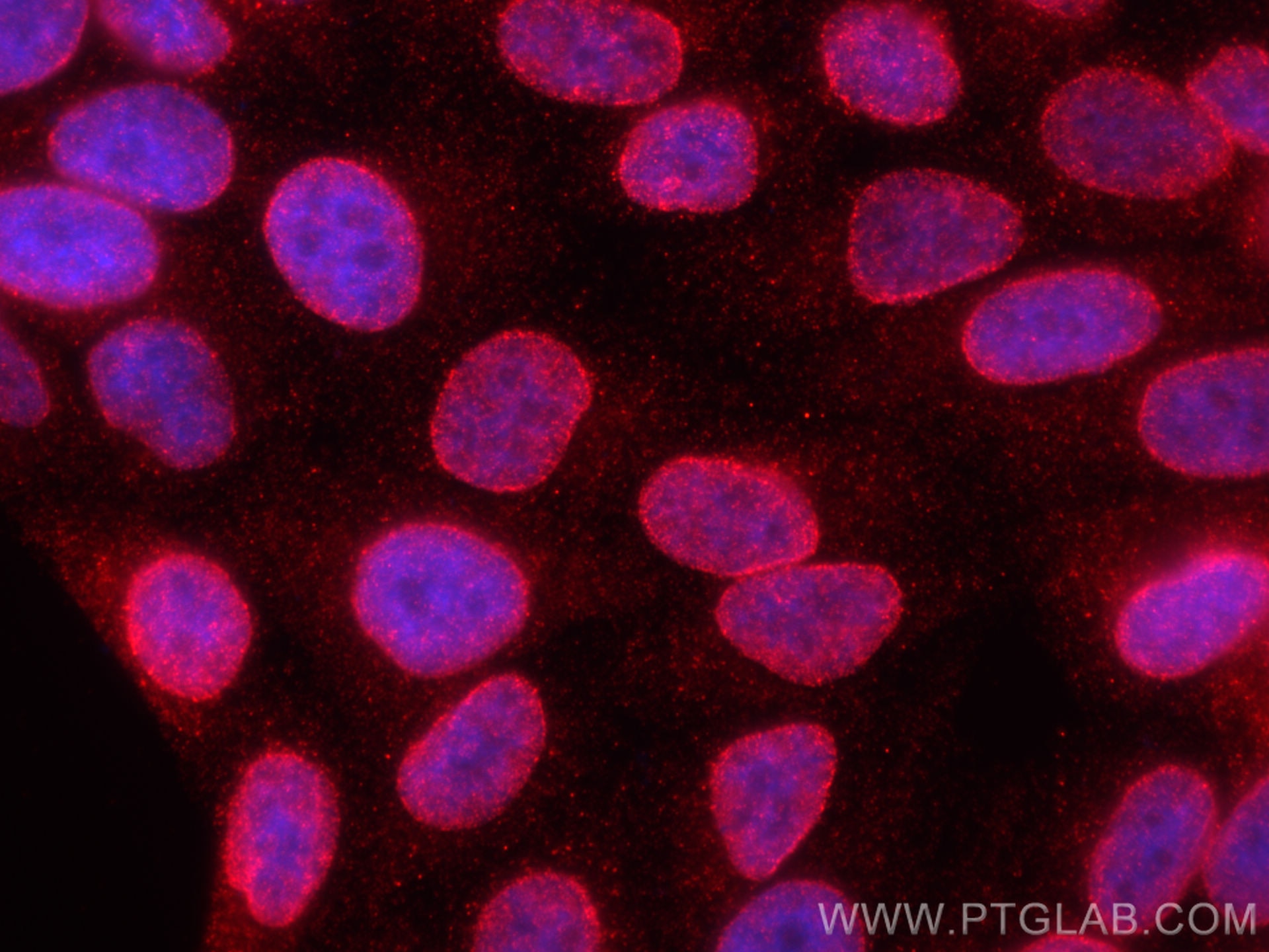 Immunofluorescence (IF) / fluorescent staining of HepG2 cells using RANGAP1 Polyclonal antibody (11102-1-AP)