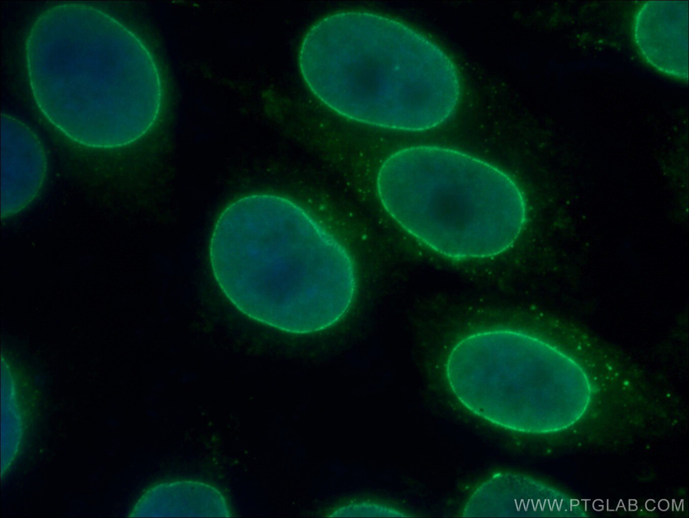 Immunofluorescence (IF) / fluorescent staining of HepG2 cells using RANGAP1 Polyclonal antibody (11102-1-AP)