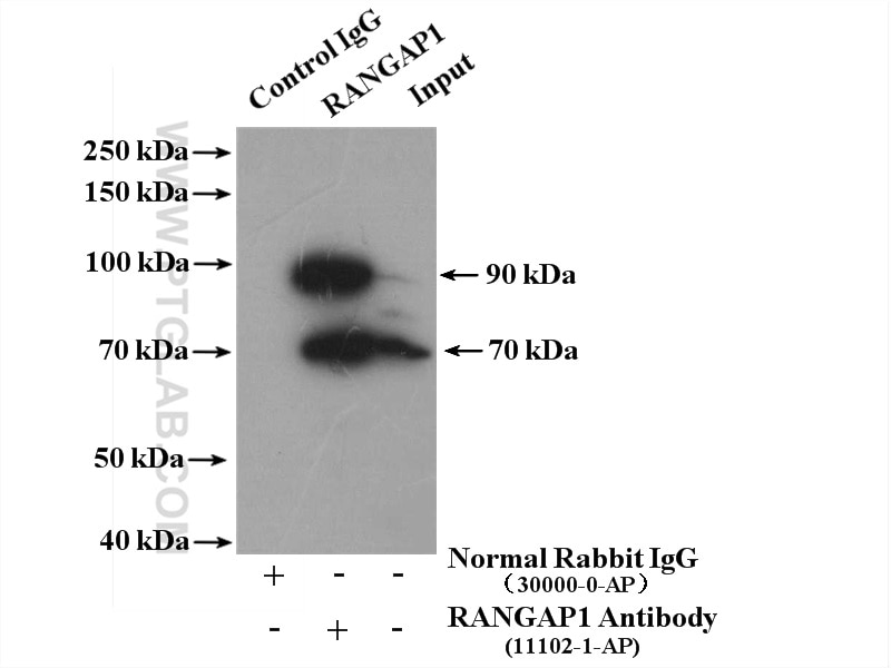 Immunoprecipitation (IP) experiment of HEK-293 cells using RANGAP1 Polyclonal antibody (11102-1-AP)