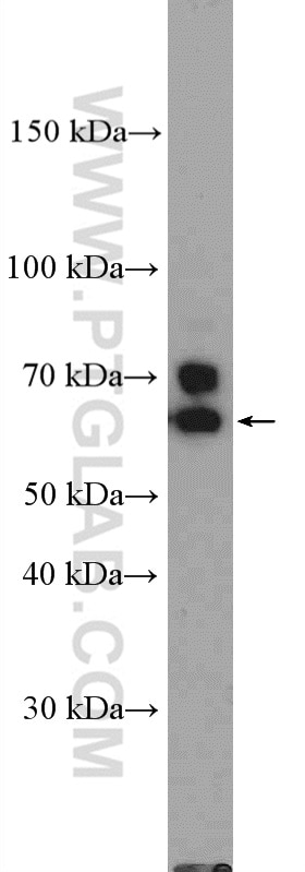 Western Blot (WB) analysis of HEK-293 cells using RANGAP1 Polyclonal antibody (11102-1-AP)
