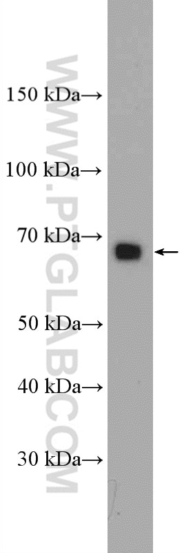RANGAP1 Polyclonal antibody
