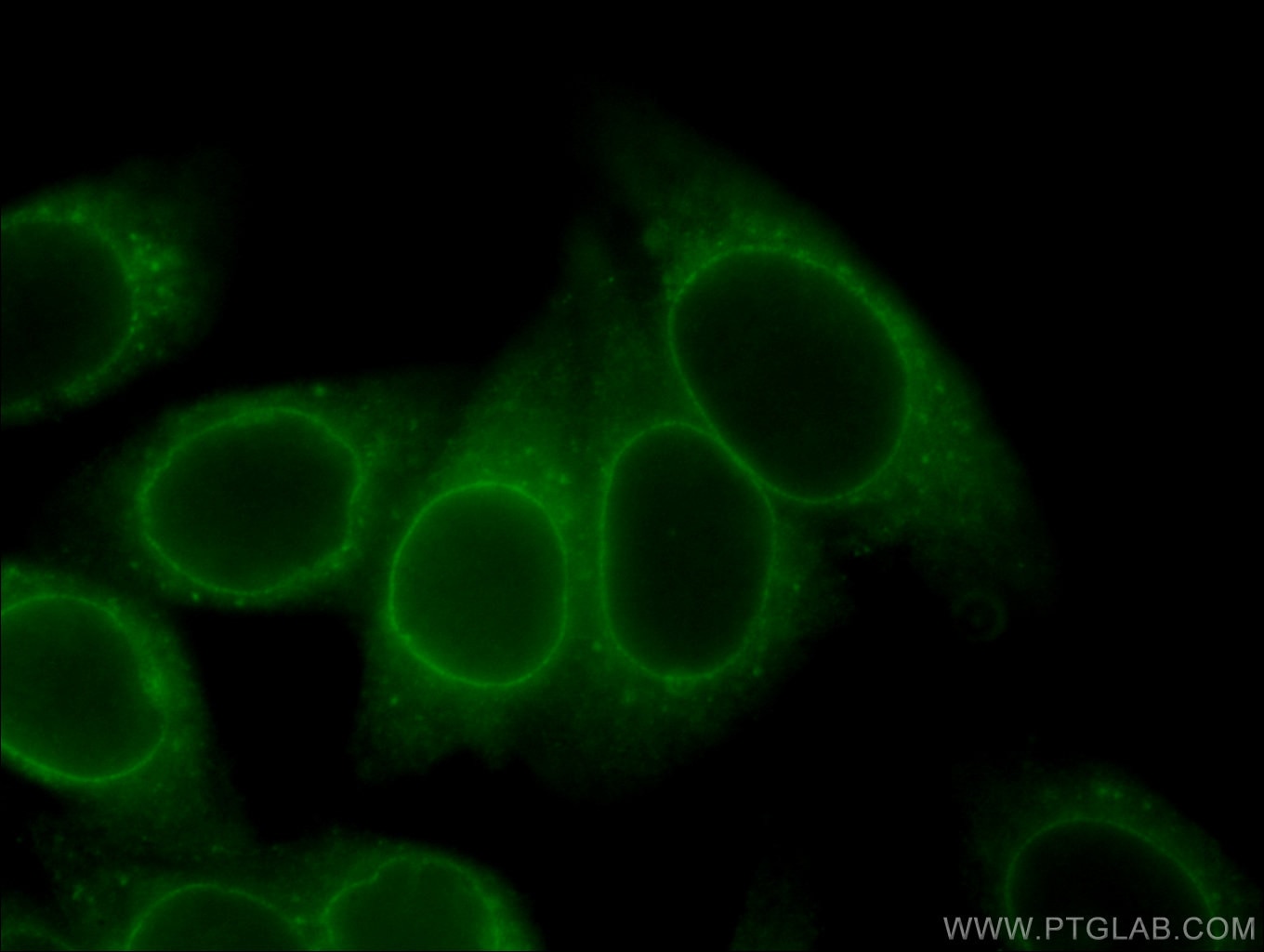 Immunofluorescence (IF) / fluorescent staining of HepG2 cells using RANGAP1 Monoclonal antibody (67146-1-Ig)