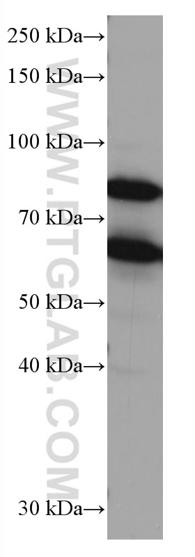 Western Blot (WB) analysis of HeLa cells using RANGAP1 Monoclonal antibody (67146-1-Ig)