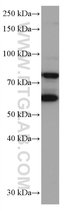 Western Blot (WB) analysis of MCF-7 cells using RANGAP1 Monoclonal antibody (67146-1-Ig)