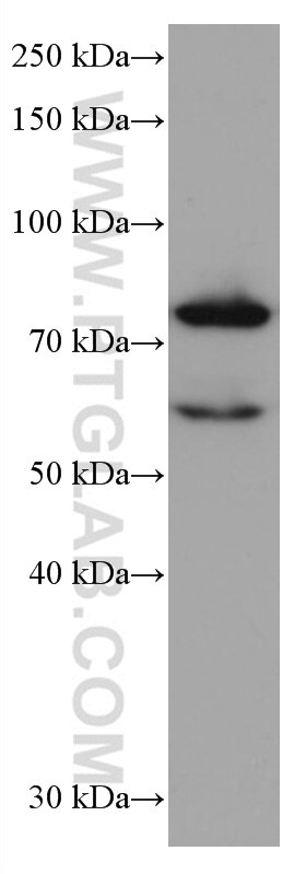 Western Blot (WB) analysis of Jurkat cells using RANGAP1 Monoclonal antibody (67146-1-Ig)