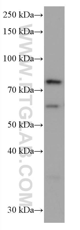 Western Blot (WB) analysis of HSC-T6 cells using RANGAP1 Monoclonal antibody (67146-1-Ig)