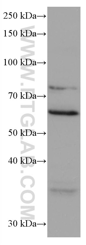 Western Blot (WB) analysis of NIH/3T3 cells using RANGAP1 Monoclonal antibody (67146-1-Ig)