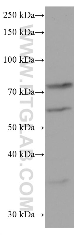 Western Blot (WB) analysis of 4T1 cells using RANGAP1 Monoclonal antibody (67146-1-Ig)
