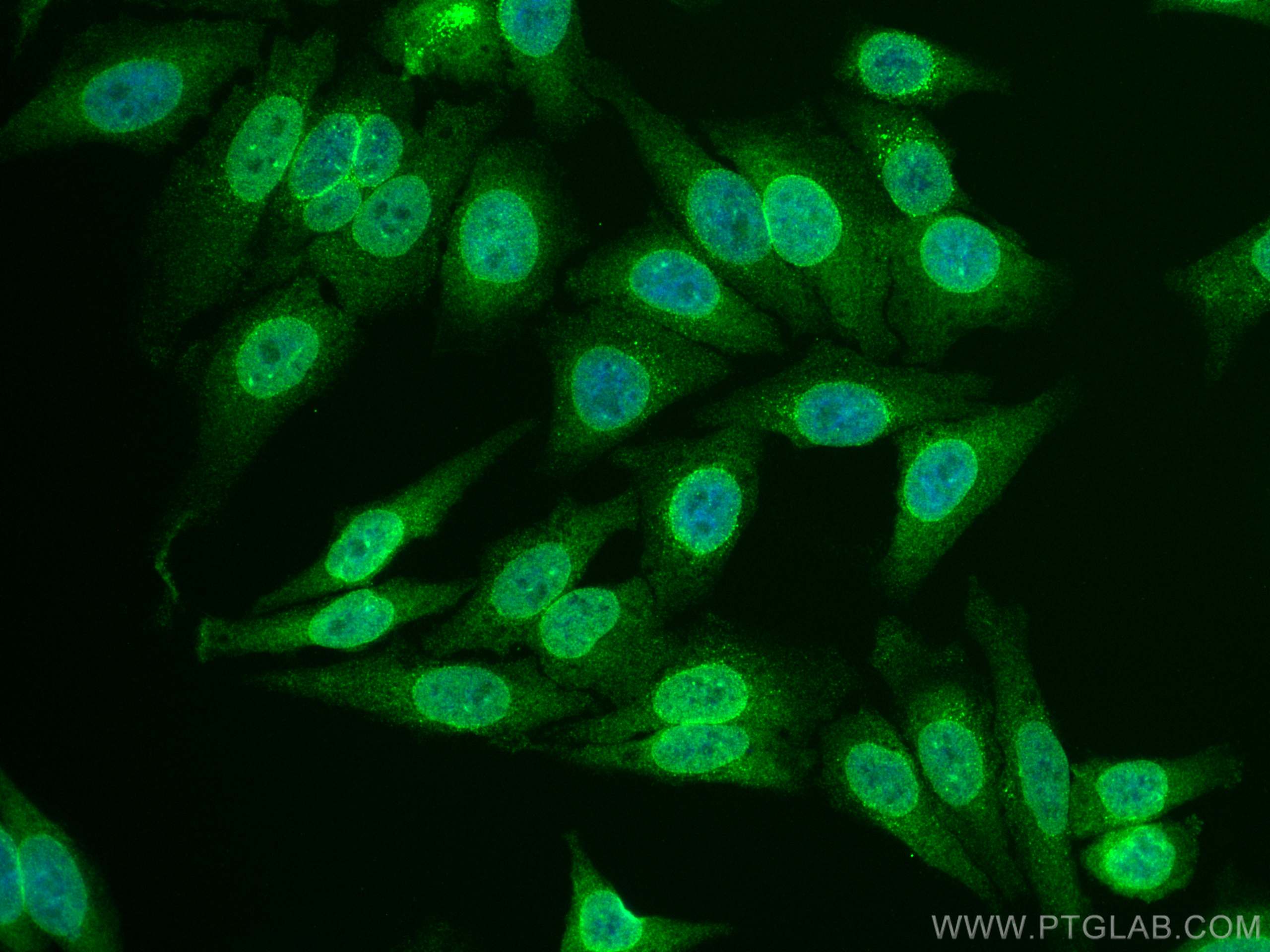 Immunofluorescence (IF) / fluorescent staining of HepG2 cells using CoraLite® Plus 488-conjugated RANGAP1 Monoclonal a (CL488-67146)