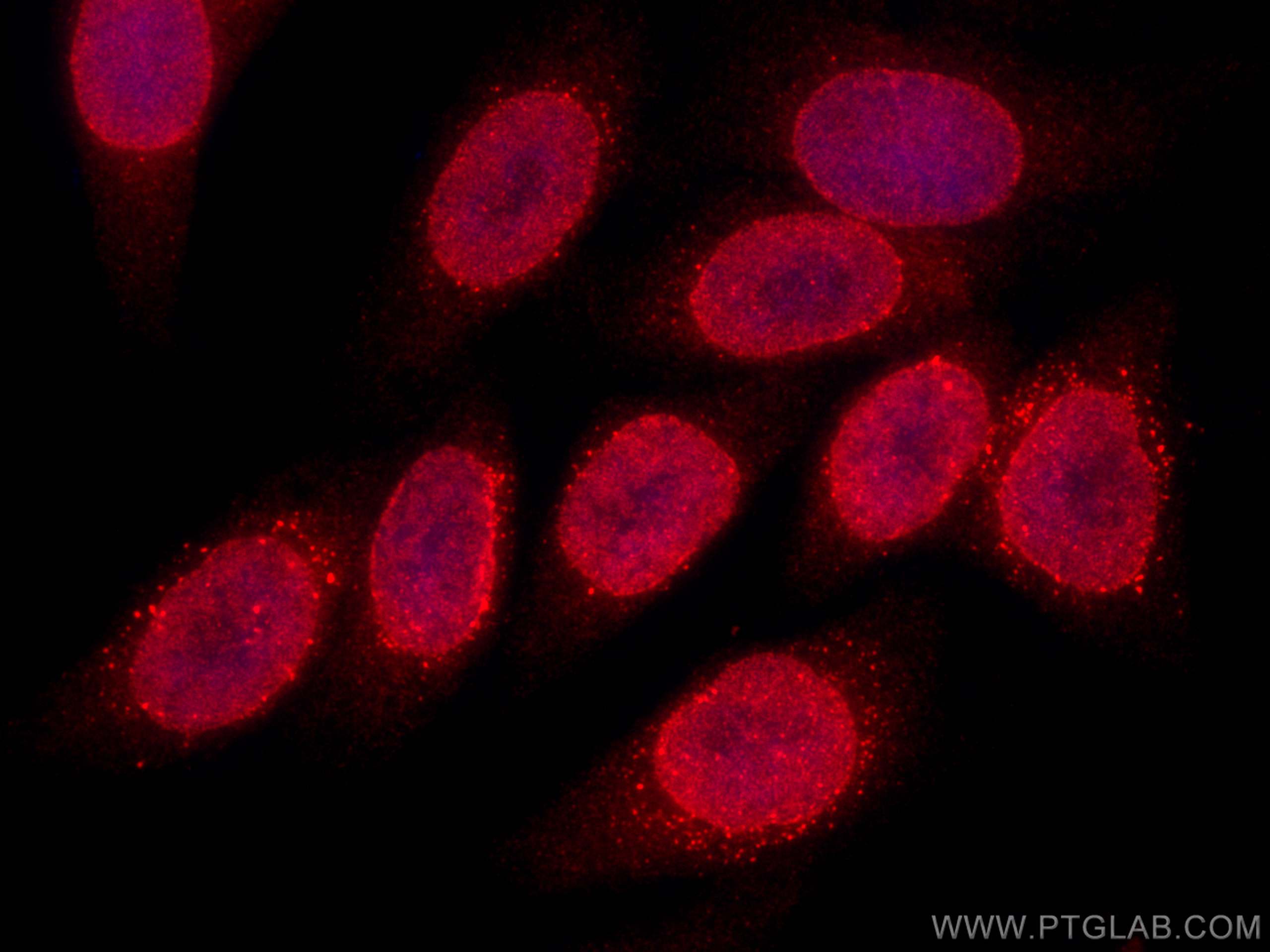Immunofluorescence (IF) / fluorescent staining of HepG2 cells using CoraLite® Plus 594-conjugated RANGAP1 Monoclonal a (CL594-67146)