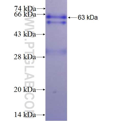 RANGAP1 fusion protein Ag1563 SDS-PAGE