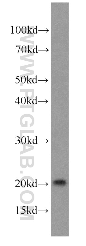 Western Blot (WB) analysis of SGC-7901 cells using RANGRF Polyclonal antibody (10552-1-AP)