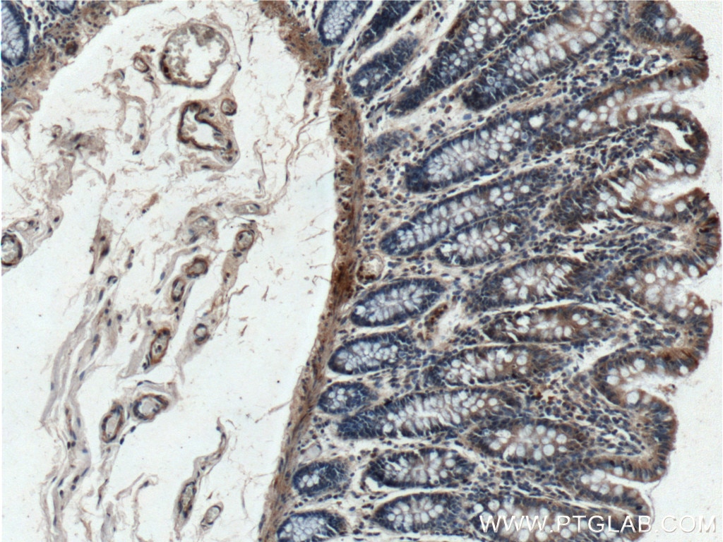 Immunohistochemistry (IHC) staining of human colon tissue using RANKL Polyclonal antibody (23408-1-AP)