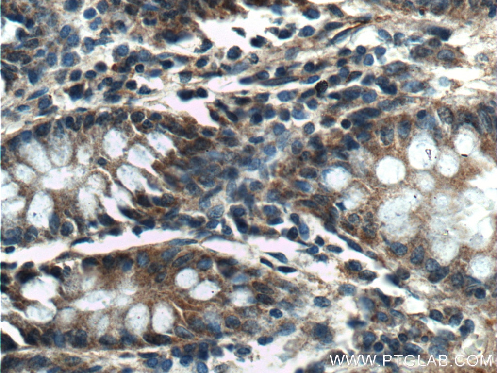Immunohistochemistry (IHC) staining of human colon tissue using RANKL Polyclonal antibody (23408-1-AP)