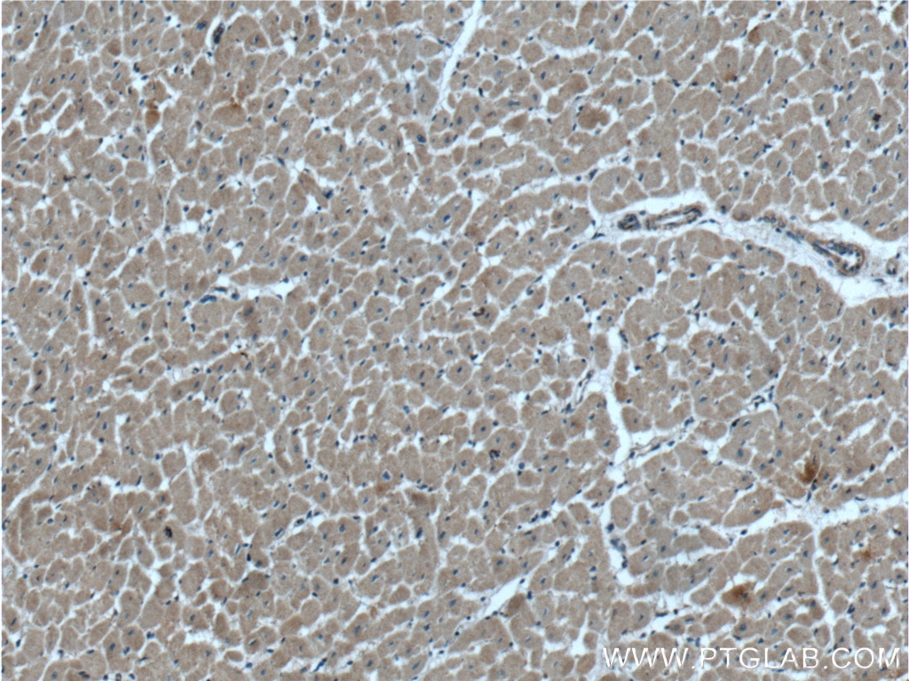 Immunohistochemistry (IHC) staining of human heart tissue using RANKL Polyclonal antibody (23408-1-AP)