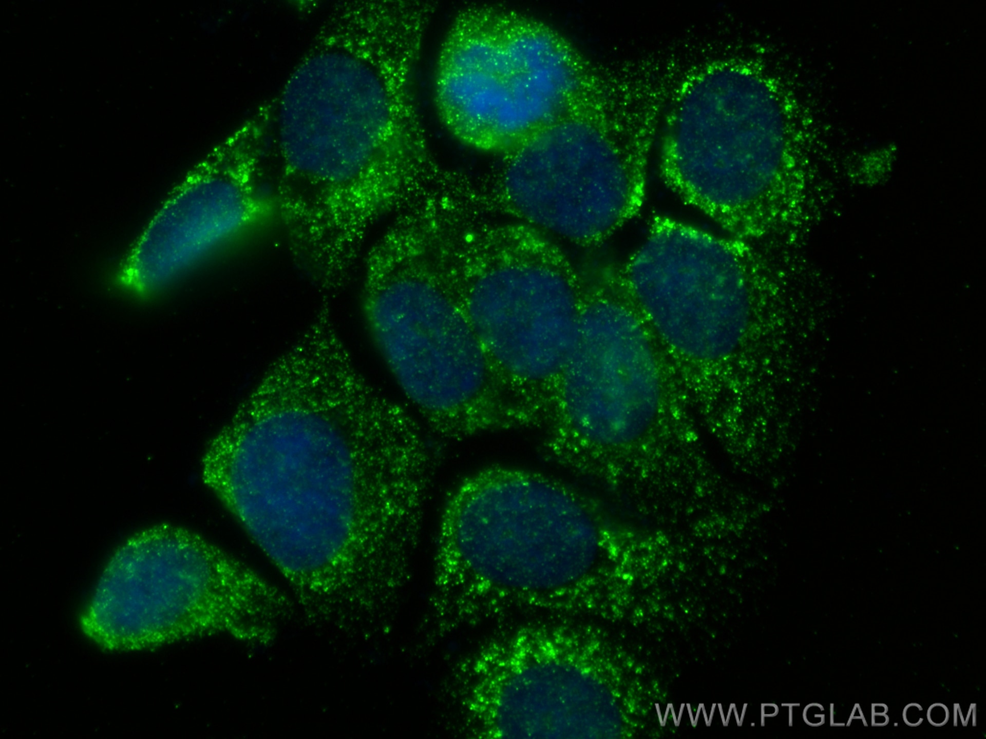 IF Staining of MCF-7 using 66610-1-Ig