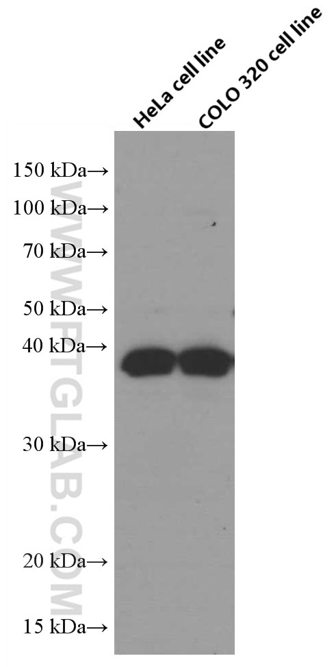 Western Blot (WB) analysis of various lysates using RANKL Monoclonal antibody (66610-1-Ig)