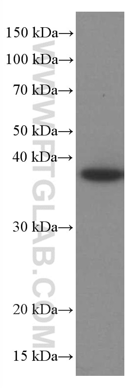 WB analysis of U2OS using 66610-1-Ig