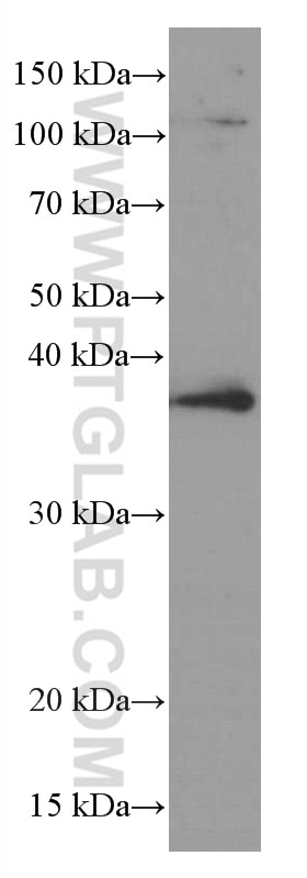 Western Blot (WB) analysis of human spleen tissue using RANKL Monoclonal antibody (66610-1-Ig)