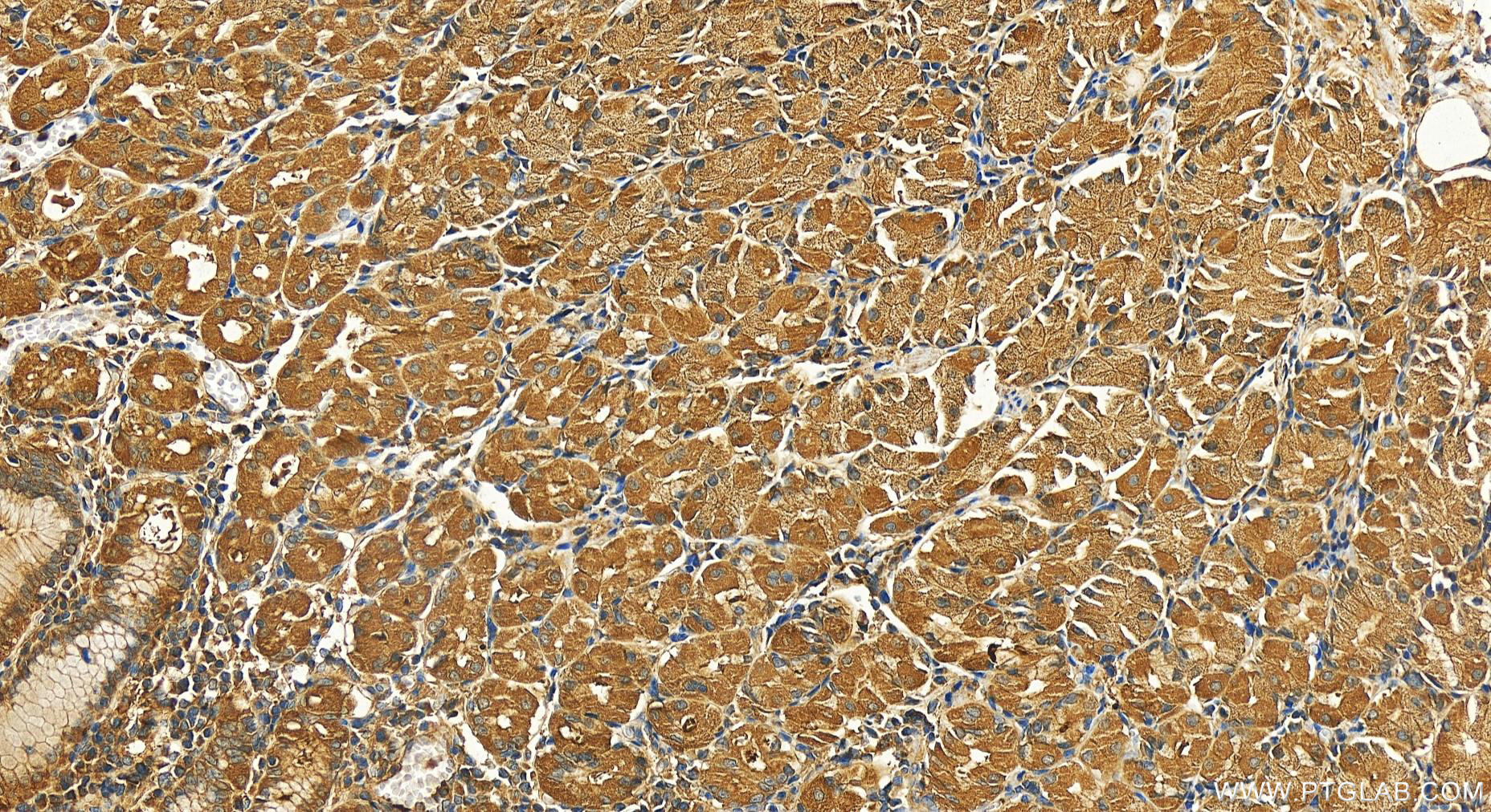 Immunohistochemistry (IHC) staining of human stomach tissue using RAP1A Polyclonal antibody (16336-1-AP)