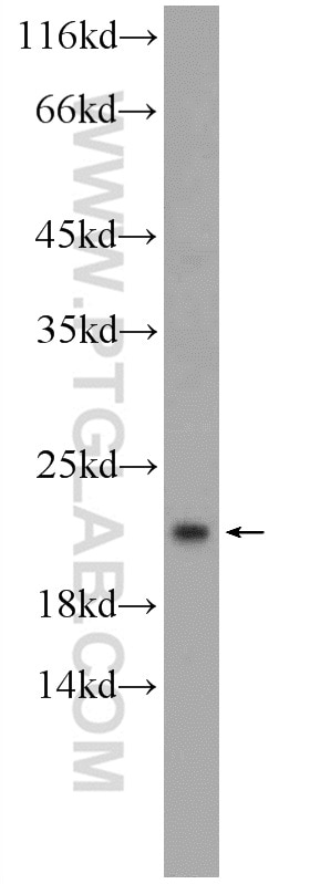 Western Blot (WB) analysis of human brain tissue using RAP1B Polyclonal antibody (10840-1-AP)