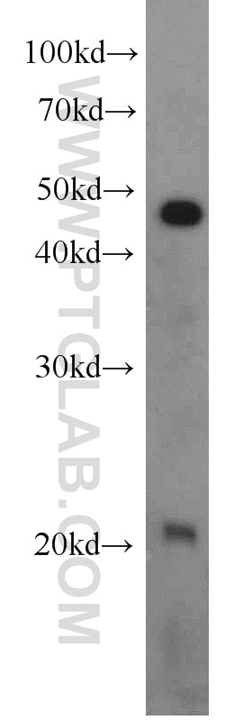 Western Blot (WB) analysis of mouse brain tissue using RAP1B Polyclonal antibody (10840-1-AP)