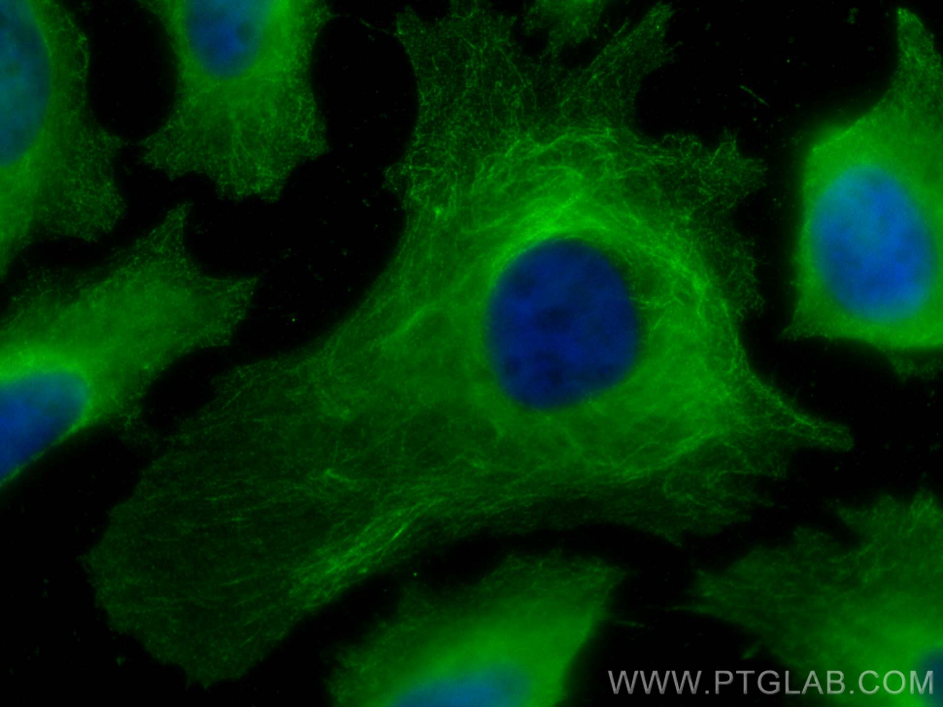 Immunofluorescence (IF) / fluorescent staining of HeLa cells using RAP1B Monoclonal antibody (67174-1-Ig)
