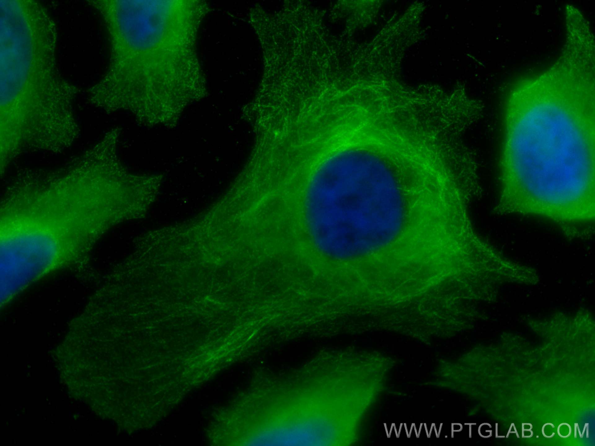 IF Staining of HeLa using 67174-1-Ig