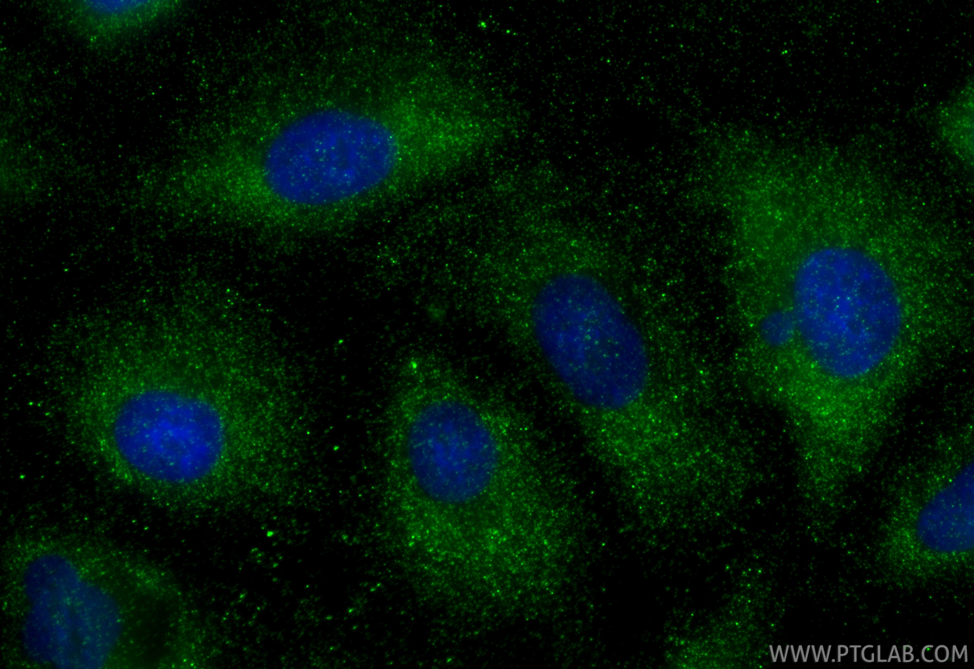 IF Staining of A549 using 88443-1-RR Immunofluorescence (IF) / fluorescent staining of A549 cells using RAP1B Recombinant monoclonal antibody (88443-1-RR)