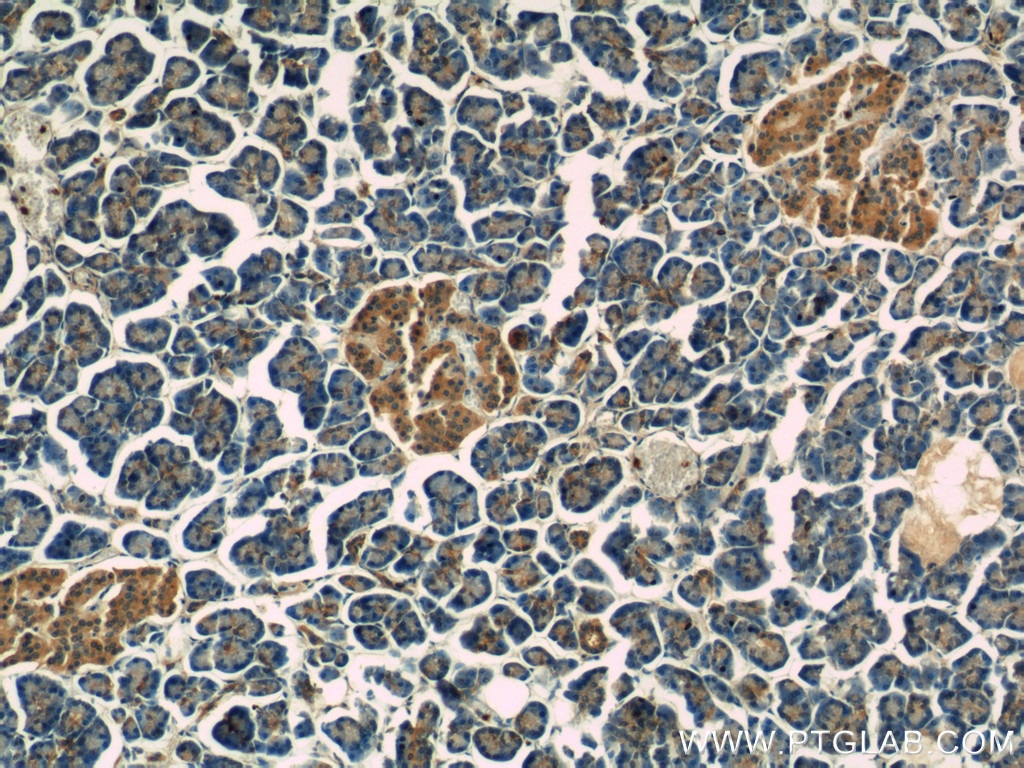 Immunohistochemistry (IHC) staining of human pancreas tissue using RAP1GAP Polyclonal antibody (14229-1-AP)