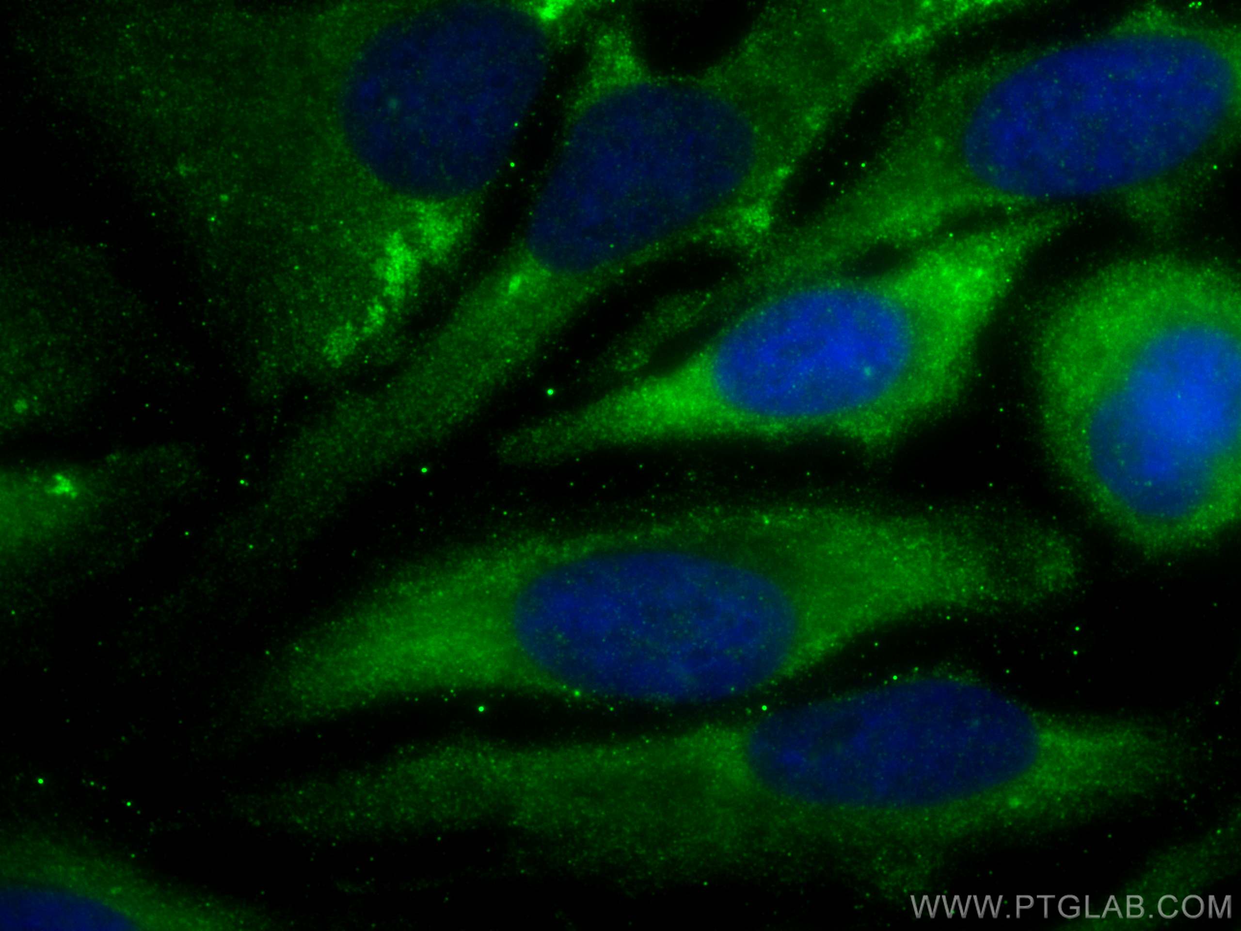 Immunofluorescence (IF) / fluorescent staining of HeLa cells using RAP1GAP Polyclonal antibody (19174-1-AP)