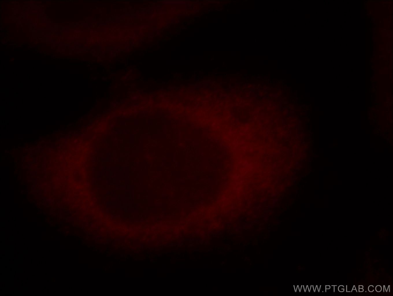 Immunofluorescence (IF) / fluorescent staining of HeLa cells using RAP1GAP Polyclonal antibody (19174-1-AP)