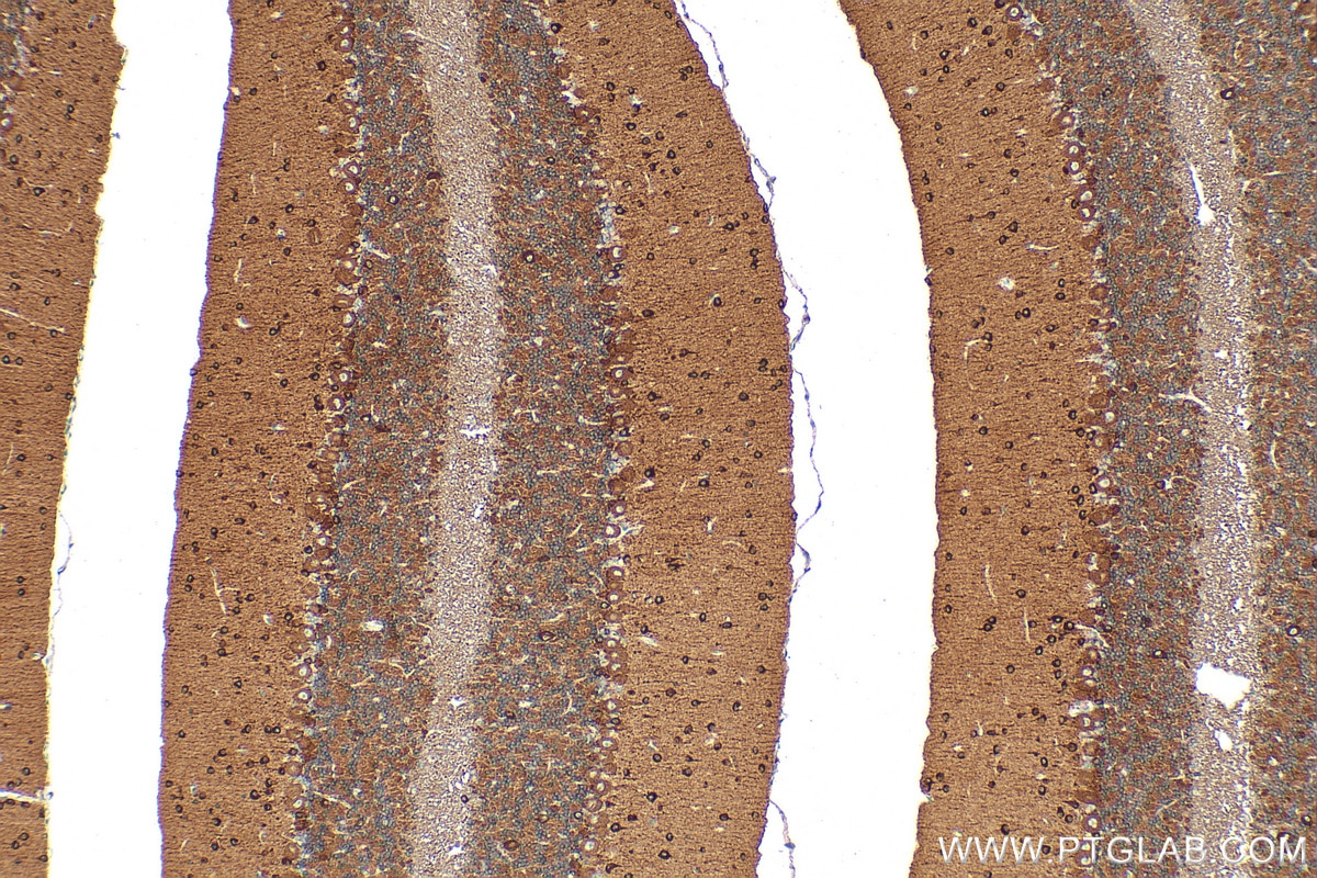 Immunohistochemistry (IHC) staining of mouse cerebellum tissue using RAP1GAP Polyclonal antibody (19174-1-AP)