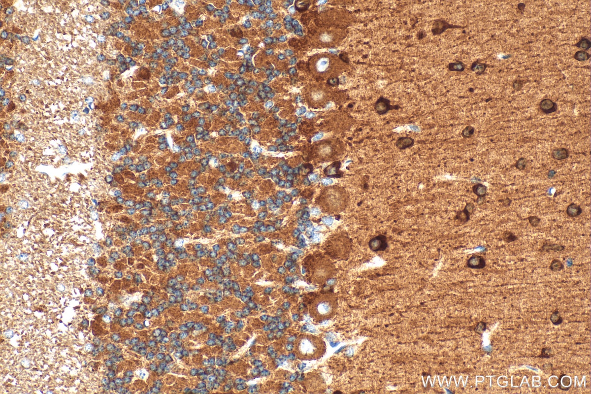 Immunohistochemistry (IHC) staining of mouse cerebellum tissue using RAP1GAP Polyclonal antibody (19174-1-AP)
