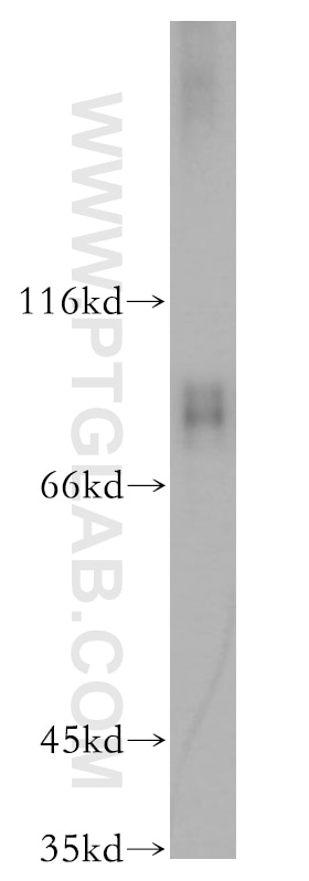 Western Blot (WB) analysis of HeLa cells using RAP1GAP Polyclonal antibody (19174-1-AP)