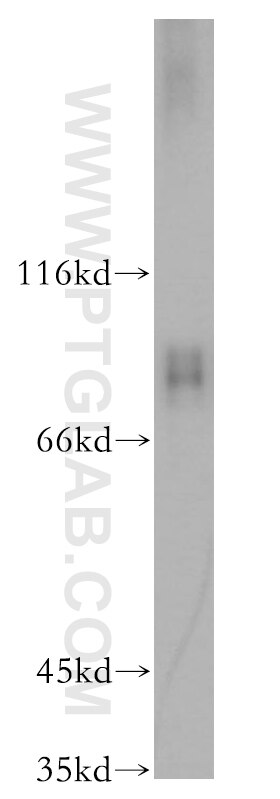 Western Blot (WB) analysis of HeLa cells using RAP1GAP Polyclonal antibody (19174-1-AP)