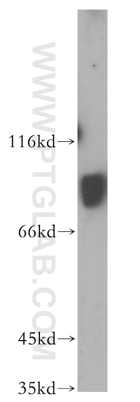 Western Blot (WB) analysis of Jurkat cells using RAP1GAP Polyclonal antibody (19174-1-AP)