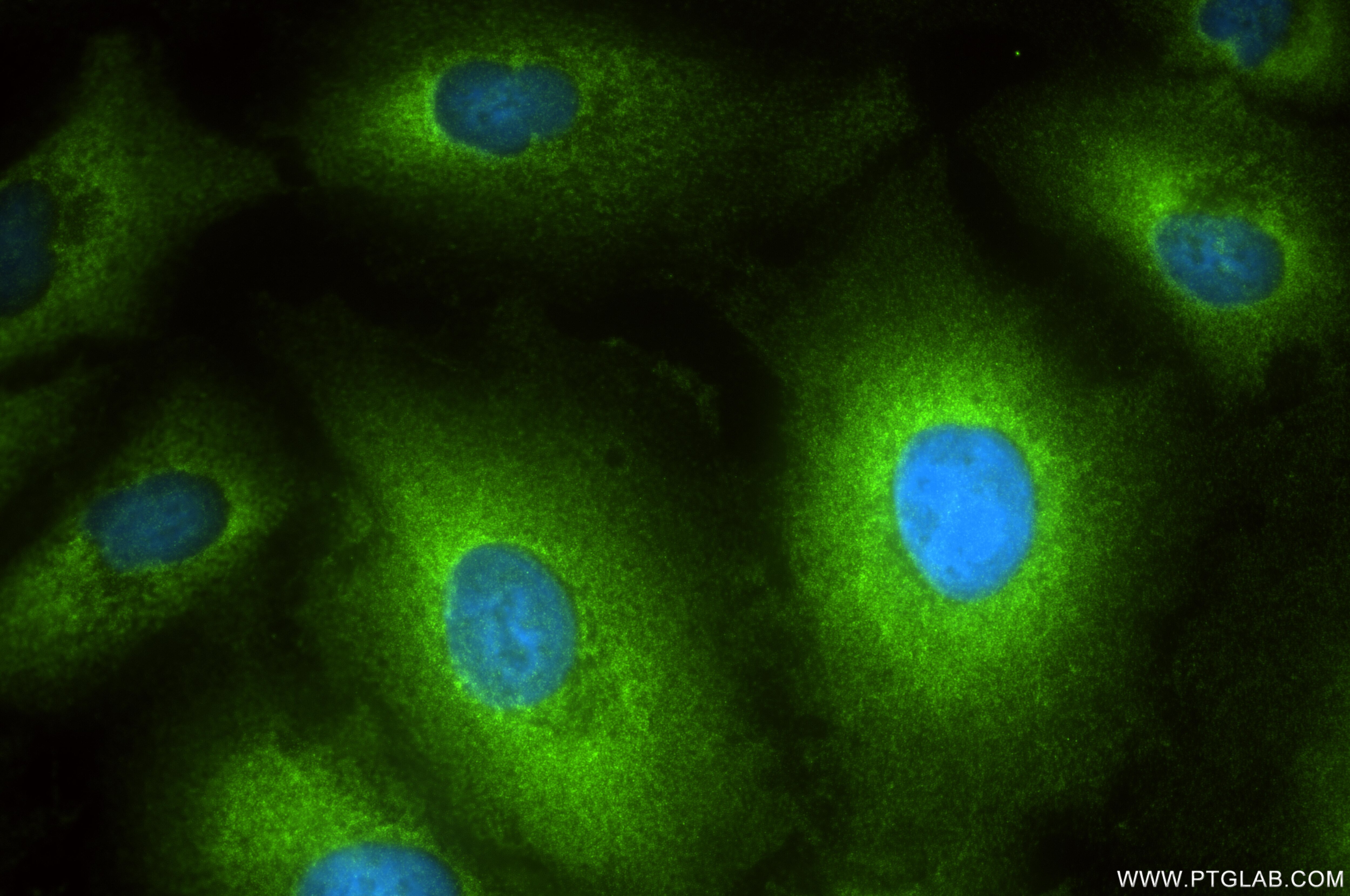 Immunofluorescence (IF) / fluorescent staining of A549 cells using RAP1GAP Recombinant antibody (86011-1-RR)