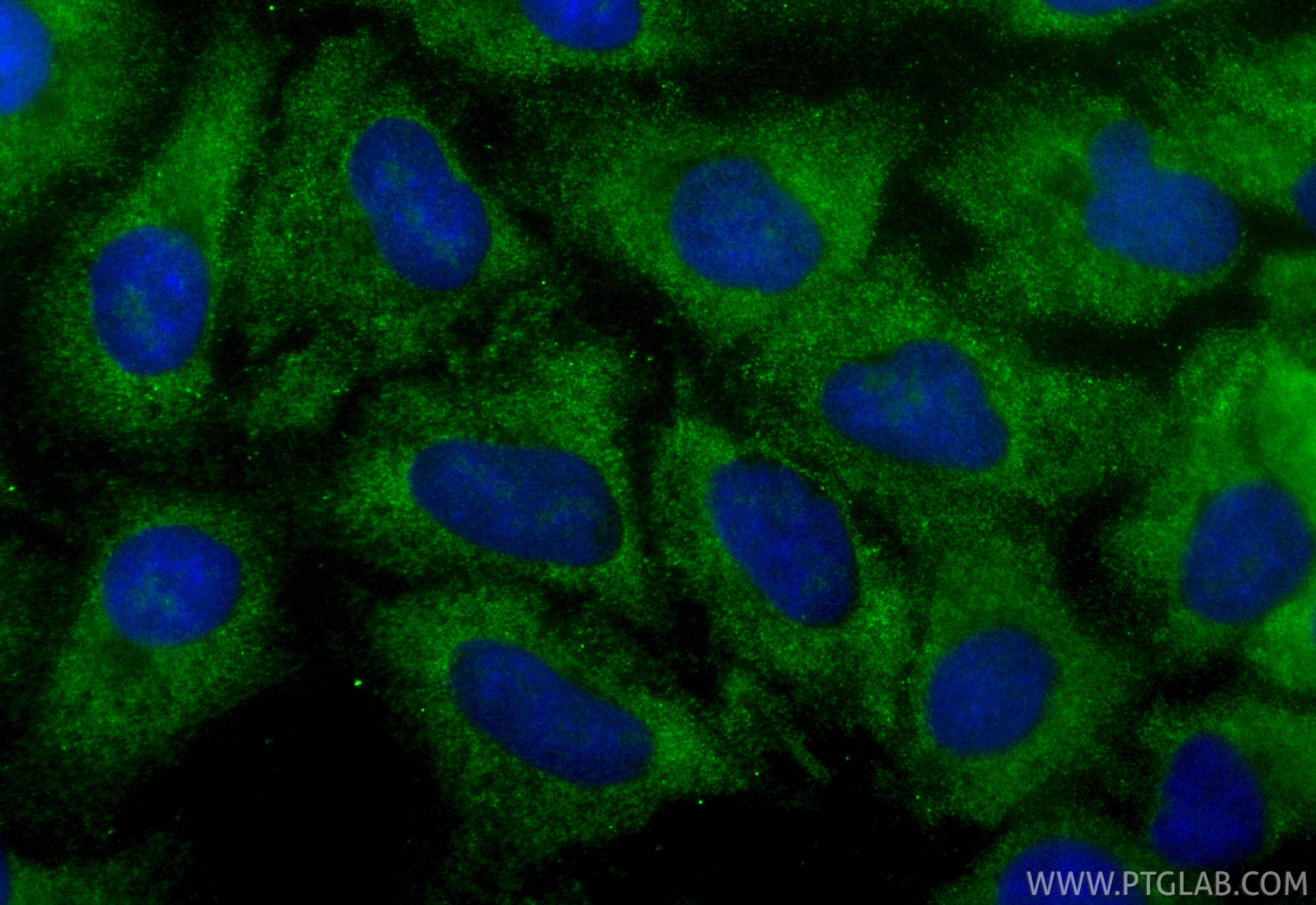 Immunofluorescence (IF) / fluorescent staining of A549 cells using CoraLite® Plus 488-conjugated RAP1GAP Recombinant  (CL488-86011)